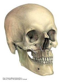 Osteotomy of the upper jaw