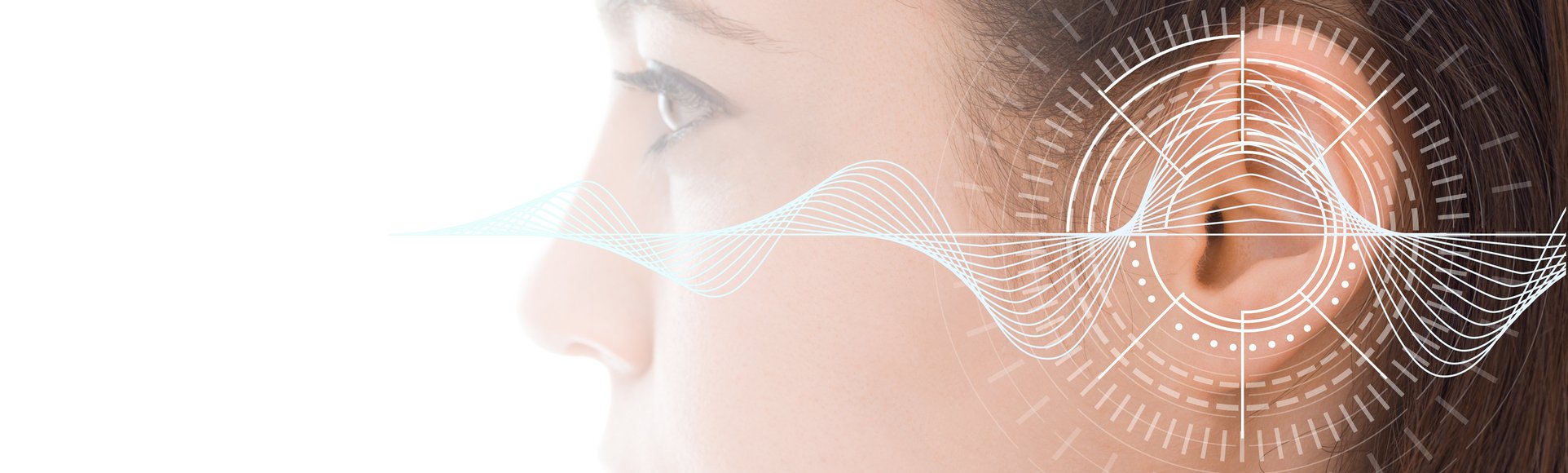 Ein Cochlea-Implantat ermöglicht Menschen mit hochgradigem Hörverlust oder Gehörlosigkeit das Hören.