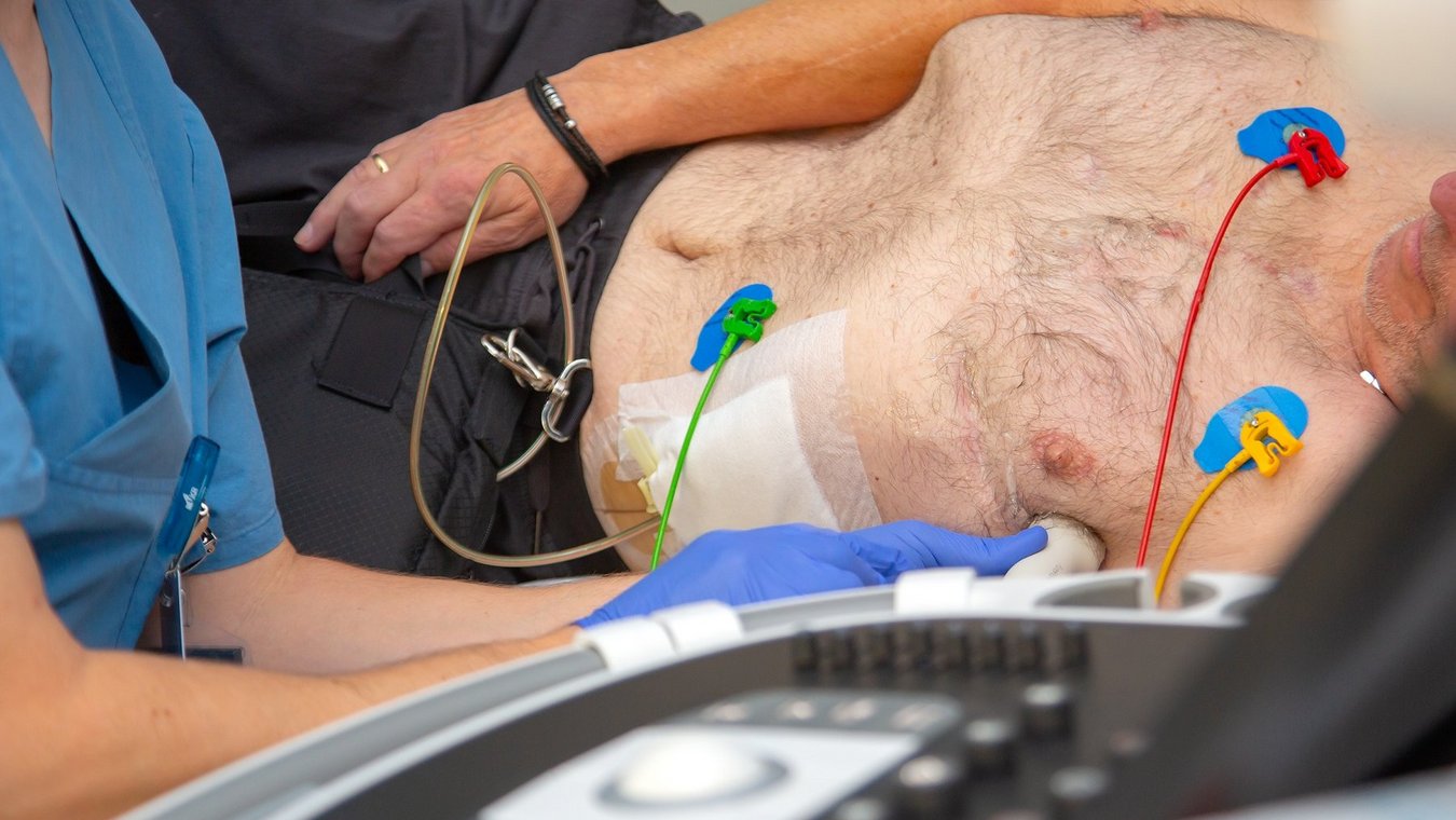 UKR, Uniklinikum Regensburg, Universitätsklinikum Regensburg, regensburg, HTC, Herz-, Thorax- und herznahe Gefäßchirurgie, Prof. Dr. Daniele Camboni, Kunstherz, Kunstherzsprechstunde, Organtransplantation