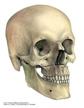 Osteotomie des Oberkiefers in der Le Fort I-Ebene 